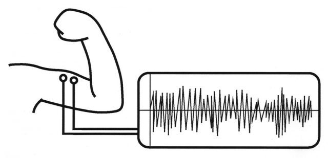 筋電位を波形として描いたものが筋電図。
