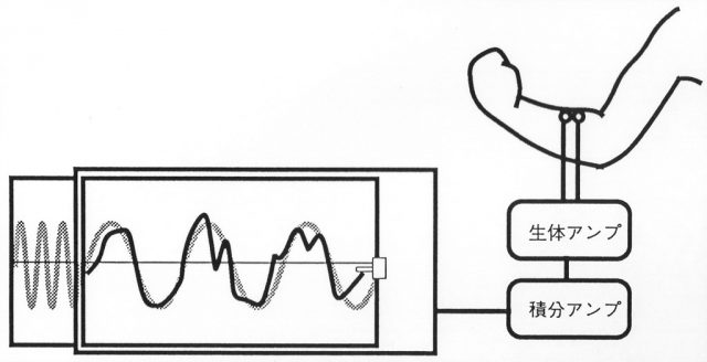 あらかじめ記録紙に書かれたsinカーブのラインを積分アンプで処理した筋電図の波形でなぞる。